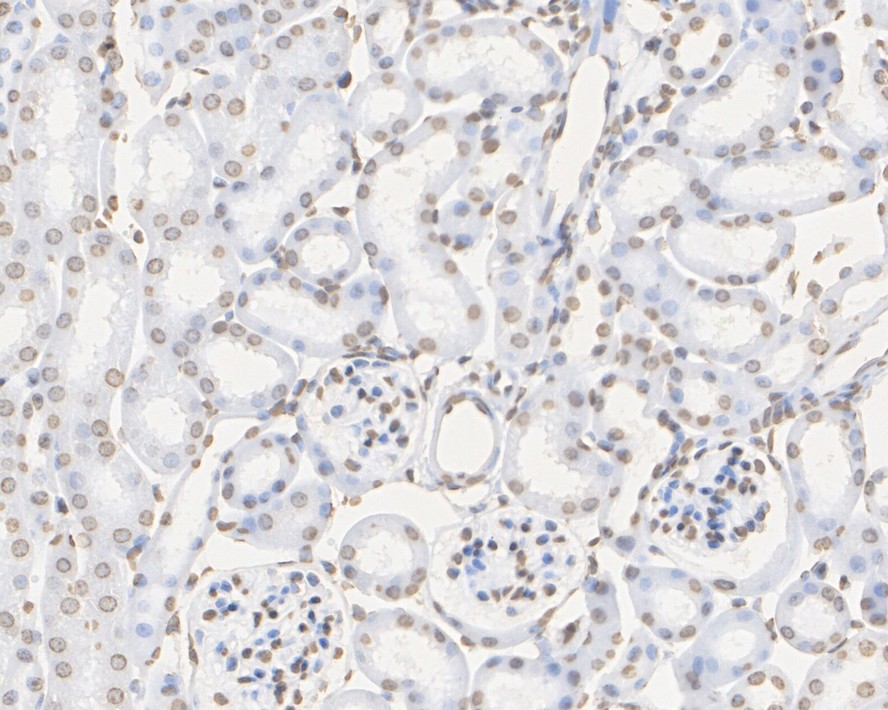 Immunohistochemical analysis of paraffin-embedded rat skin tissue with Rabbit anti-Histone H3 antibody (ET1701-64) at 1/5,000 dilution.<br />
<br />
The section was pre-treated using heat mediated antigen retrieval with sodium citrate buffer (pH 6.0) for 2 minutes. The tissues were blocked in 1% BSA for 20 minutes at room temperature, washed with ddH2O and PBS, and then probed with the primary antibody (ET1701-64) at 1/5,000 dilution for 1 hour at room temperature. The detection was performed using an HRP conjugated compact polymer system. DAB was used as the chromogen. Tissues were counterstained with hematoxylin and mounted with DPX.