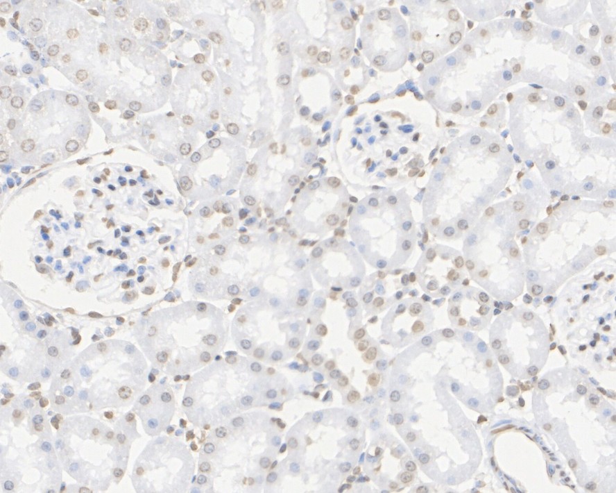 Immunohistochemical analysis of paraffin-embedded human spleen tissue using anti-Histone H3 antibody. The section was pre-treated using heat mediated antigen retrieval with Tris-EDTA buffer (pH 9.0) for 20 minutes.The tissues were blocked in 1% BSA for 30 minutes at room temperature, washed with ddH2O and PBS, and then probed with the primary antibody (ET1701-64, 1/50) for 30 minutes at room temperature. The detection was performed using an HRP conjugated compact polymer system. DAB was used as the chromogen. Tissues were counterstained with hematoxylin and mounted with DPX.