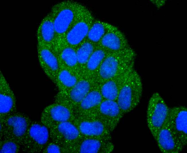 ICC staining of HDAC6 in Hela cells (green). Formalin fixed cells were permeabilized with 0.1% Triton X-100 in TBS for 10 minutes at room temperature and blocked with 1% Blocker BSA for 15 minutes at room temperature. Cells were probed with the primary antibody (ET1701-66, 1/50) for 1 hour at room temperature, washed with PBS. Alexa Fluor®488 Goat anti-Rabbit IgG was used as the secondary antibody at 1/1,000 dilution. The nuclear counter stain is DAPI (blue).