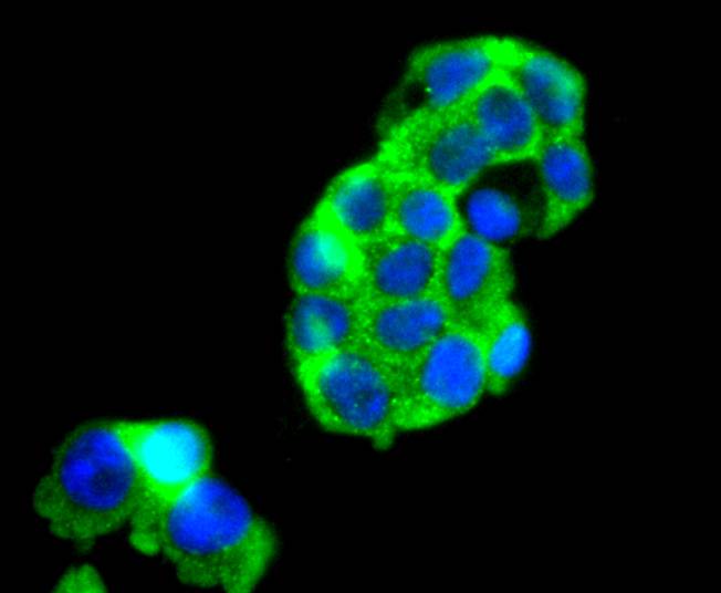 ICC staining of FOXO4 in 293T cells (green). Formalin fixed cells were permeabilized with 0.1% Triton X-100 in TBS for 10 minutes at room temperature and blocked with 1% Blocker BSA for 15 minutes at room temperature. Cells were probed with the primary antibody (ET1701-67, 1/50) for 1 hour at room temperature, washed with PBS. Alexa Fluor®488 Goat anti-Rabbit IgG was used as the secondary antibody at 1/1,000 dilution. The nuclear counter stain is DAPI (blue).