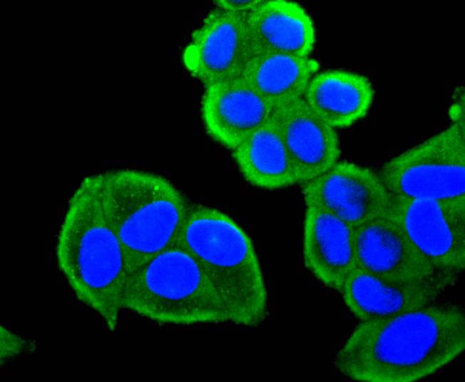 ICC staining of FOXO4 in Hela cells (green). Formalin fixed cells were permeabilized with 0.1% Triton X-100 in TBS for 10 minutes at room temperature and blocked with 1% Blocker BSA for 15 minutes at room temperature. Cells were probed with the primary antibody (ET1701-67, 1/50) for 1 hour at room temperature, washed with PBS. Alexa Fluor®488 Goat anti-Rabbit IgG was used as the secondary antibody at 1/1,000 dilution. The nuclear counter stain is DAPI (blue).