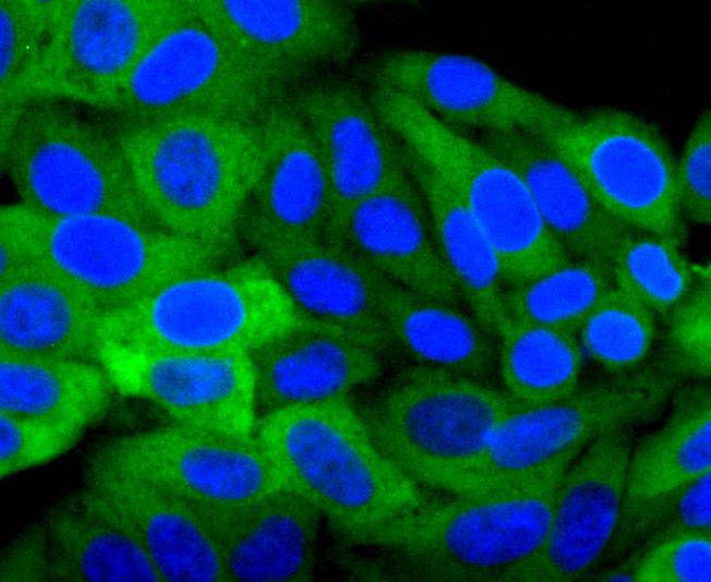 ICC staining of Hsp27 in Hela cells (green). Formalin fixed cells were permeabilized with 0.1% Triton X-100 in TBS for 10 minutes at room temperature and blocked with 1% Blocker BSA for 15 minutes at room temperature. Cells were probed with the primary antibody (ET1701-70, 1/50) for 1 hour at room temperature, washed with PBS. Alexa Fluor®488 Goat anti-Rabbit IgG was used as the secondary antibody at 1/1,000 dilution. The nuclear counter stain is DAPI (blue).