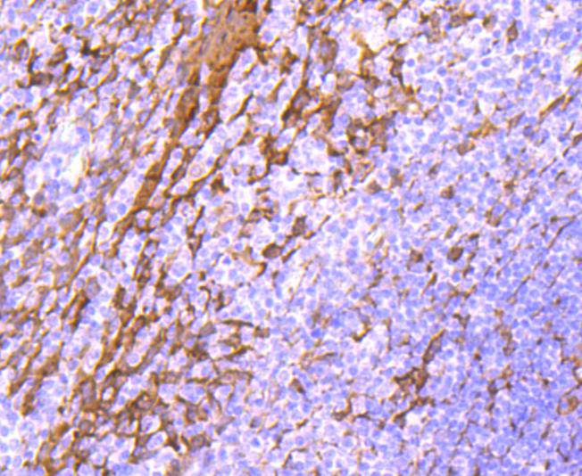 ICC staining of Hsp27 in HepG2 cells (green). Formalin fixed cells were permeabilized with 0.1% Triton X-100 in TBS for 10 minutes at room temperature and blocked with 1% Blocker BSA for 15 minutes at room temperature. Cells were probed with the primary antibody (ET1701-70, 1/50) for 1 hour at room temperature, washed with PBS. Alexa Fluor®488 Goat anti-Rabbit IgG was used as the secondary antibody at 1/1,000 dilution. The nuclear counter stain is DAPI (blue).