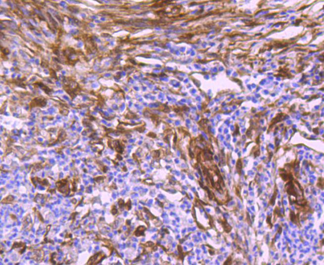 Immunohistochemical analysis of paraffin-embedded human tonsil tissue using anti-Hsp27 antibody. The section was pre-treated using heat mediated antigen retrieval with Tris-EDTA buffer (pH 8.0-8.4) for 20 minutes.The tissues were blocked in 5% BSA for 30 minutes at room temperature, washed with ddH2O and PBS, and then probed with the primary antibody (ET1701-70, 1/50) for 30 minutes at room temperature. The detection was performed using an HRP conjugated compact polymer system. DAB was used as the chromogen. Tissues were counterstained with hematoxylin and mounted with DPX.