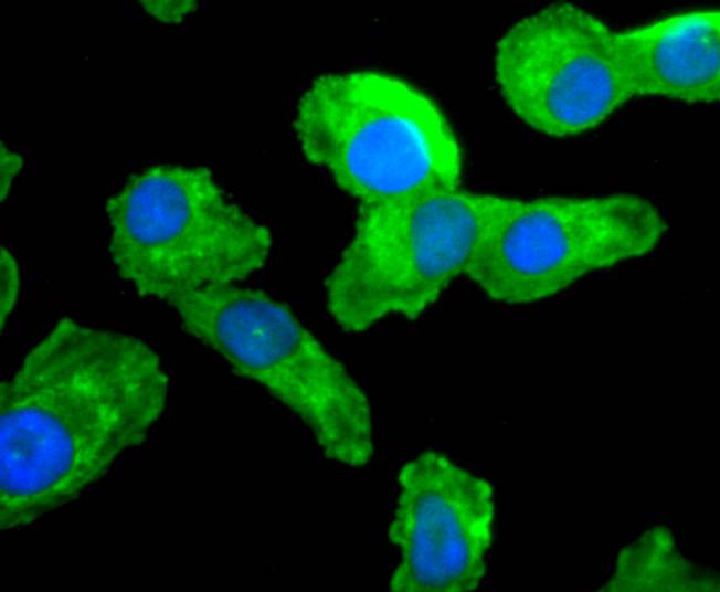 ICC staining CDC45 in A549 cells (green). The nuclear counter stain is DAPI (blue). Cells were fixed in paraformaldehyde, permeabilised with 0.25% Triton X100/PBS.