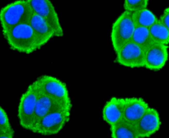 ICC staining CDC45 in Hela cells (green). The nuclear counter stain is DAPI (blue). Cells were fixed in paraformaldehyde, permeabilised with 0.25% Triton X100/PBS.