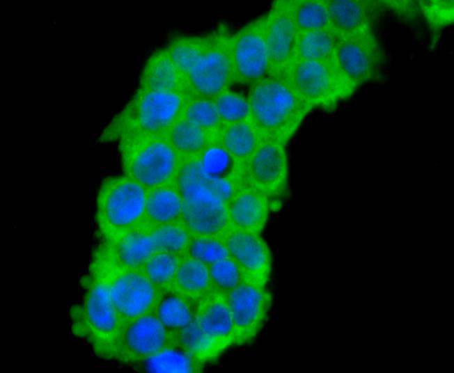 ICC staining CDC45 in 293T cells (green). The nuclear counter stain is DAPI (blue). Cells were fixed in paraformaldehyde, permeabilised with 0.25% Triton X100/PBS.