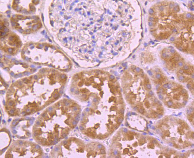 Immunohistochemical analysis of paraffin-embedded human kidney tissue using anti-CDC45 antibody. Counter stained with hematoxylin.