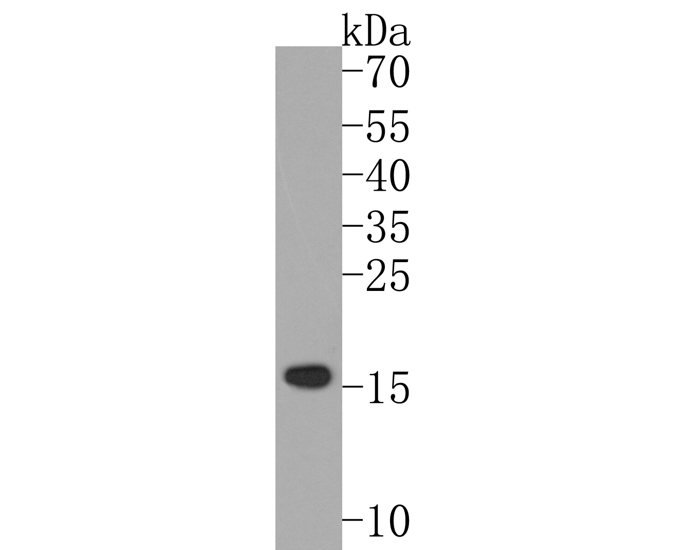 Western blot analysis of Cystatin C on mouse spleen tissue lysates. Proteins were transferred to a PVDF membrane and blocked with 5% BSA in PBS for 1 hour at room temperature. The primary antibody (ET1701-72, 1/500) was used in 5% BSA at room temperature for 2 hours. Goat Anti-Rabbit IgG - HRP Secondary Antibody (HA1001) at 1:200,000 dilution was used for 1 hour at room temperature.