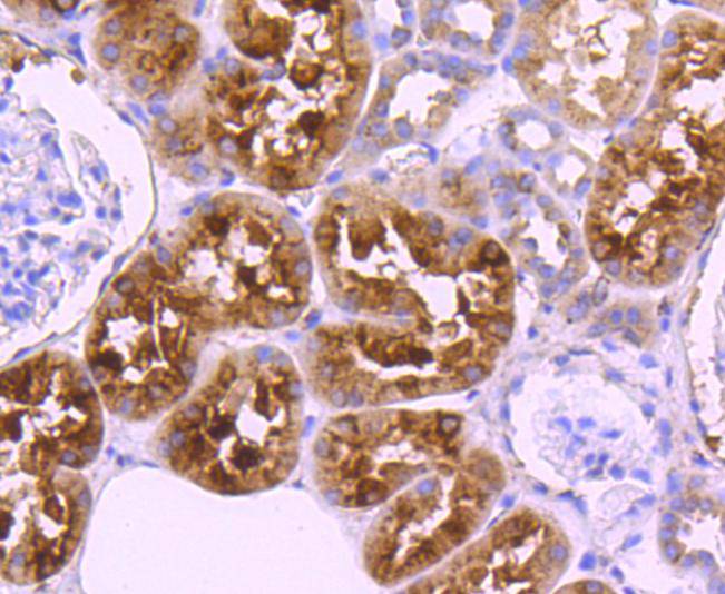 Immunohistochemical analysis of paraffin-embedded human kidney tissue using anti-Cystatin C antibody. The section was pre-treated using heat mediated antigen retrieval with Tris-EDTA buffer (pH 9.0) for 20 minutes.The tissues were blocked in 5% BSA for 30 minutes at room temperature, washed with ddH2O and PBS, and then probed with the primary antibody (ET1701-72, 1/50) for 30 minutes at room temperature. The detection was performed using an HRP conjugated compact polymer system. DAB was used as the chromogen. Tissues were counterstained with hematoxylin and mounted with DPX.