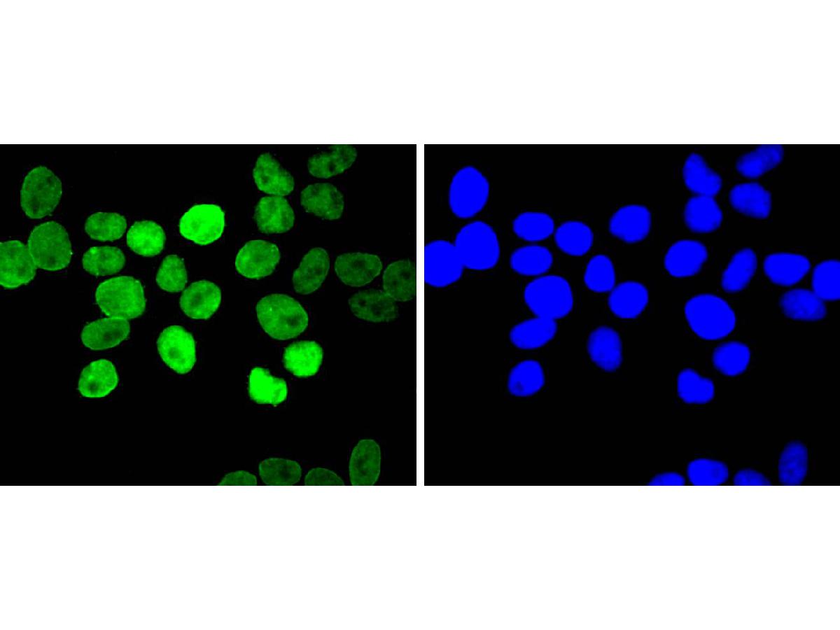 ICC staining of E2F1 in Hela cells (green). Formalin fixed cells were permeabilized with 0.1% Triton X-100 in TBS for 10 minutes at room temperature and blocked with 1% Blocker BSA for 15 minutes at room temperature. Cells were probed with the primary antibody (ET1701-73, 1/50) for 1 hour at room temperature, washed with PBS. Alexa Fluor®488 Goat anti-Rabbit IgG was used as the secondary antibody at 1/1,000 dilution. The nuclear counter stain is DAPI (blue).