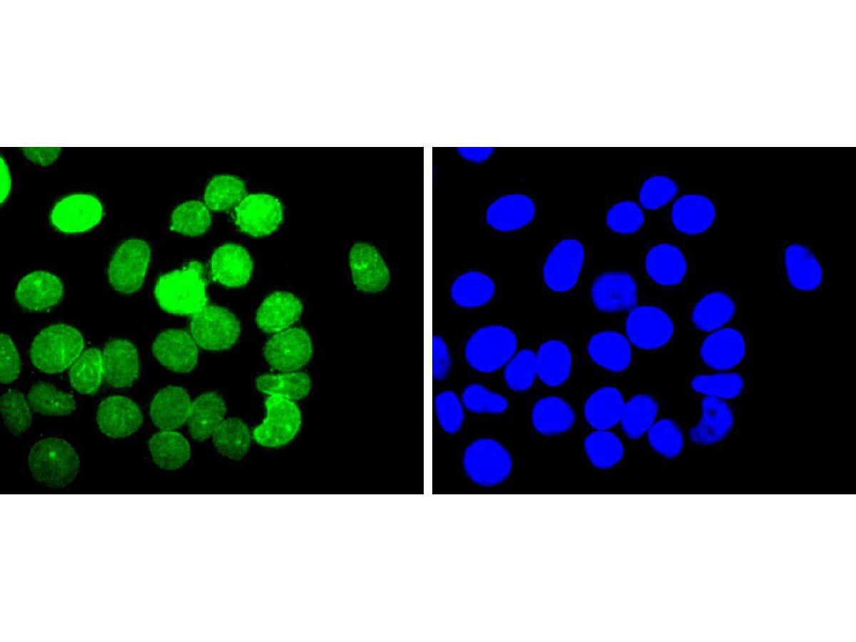 ICC staining of E2F1 in MCF-7 cells (green). Formalin fixed cells were permeabilized with 0.1% Triton X-100 in TBS for 10 minutes at room temperature and blocked with 1% Blocker BSA for 15 minutes at room temperature. Cells were probed with the primary antibody (ET1701-73, 1/50) for 1 hour at room temperature, washed with PBS. Alexa Fluor®488 Goat anti-Rabbit IgG was used as the secondary antibody at 1/1,000 dilution. The nuclear counter stain is DAPI (blue).