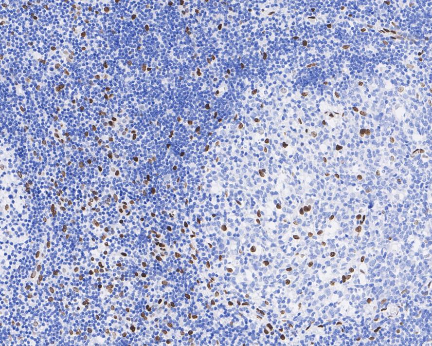 Immunohistochemical analysis of paraffin-embedded mouse pancreas tissue using anti-E2F1 antibody. The section was pre-treated using heat mediated antigen retrieval with Tris-EDTA buffer (pH 8.0-8.4) for 20 minutes.The tissues were blocked in 5% BSA for 30 minutes at room temperature, washed with ddH2O and PBS, and then probed with the primary antibody (ET1701-73, 1/50) for 30 minutes at room temperature. The detection was performed using an HRP conjugated compact polymer system. DAB was used as the chromogen. Tissues were counterstained with hematoxylin and mounted with DPX.