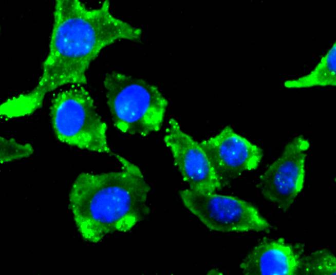 ICC staining mGluR2 in SH-SY-5Y cells (green). The nuclear counter stain is DAPI (blue). Cells were fixed in paraformaldehyde, permeabilised with 0.25% Triton X100/PBS.