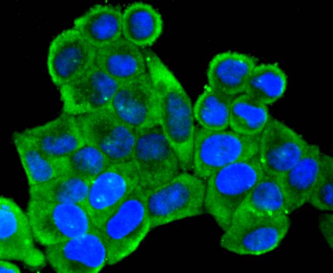 ICC staining mGluR2 in Hela cells (green). The nuclear counter stain is DAPI (blue). Cells were fixed in paraformaldehyde, permeabilised with 0.25% Triton X100/PBS.
