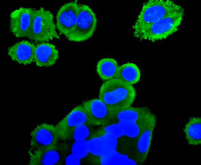 ICC staining mGluR2 in SW480 cells (green). The nuclear counter stain is DAPI (blue). Cells were fixed in paraformaldehyde, permeabilised with 0.25% Triton X100/PBS.