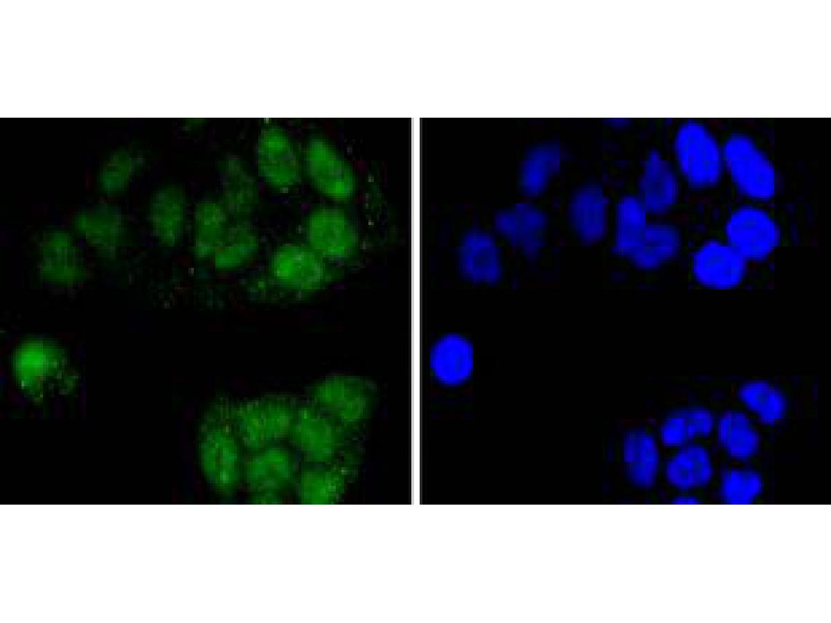 ICC staining of CDC5L in Hela cells (green). Formalin fixed cells were permeabilized with 0.1% Triton X-100 in TBS for 10 minutes at room temperature and blocked with 1% Blocker BSA for 15 minutes at room temperature. Cells were probed with the primary antibody (ET1701-75, 1/50) for 1 hour at room temperature, washed with PBS. Alexa Fluor®488 Goat anti-Rabbit IgG was used as the secondary antibody at 1/1,000 dilution. The nuclear counter stain is DAPI (blue).