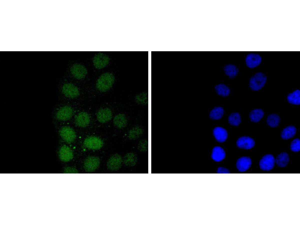ICC staining of CDC5L in MCF-7 cells (green). Formalin fixed cells were permeabilized with 0.1% Triton X-100 in TBS for 10 minutes at room temperature and blocked with 1% Blocker BSA for 15 minutes at room temperature. Cells were probed with the primary antibody (ET1701-75, 1/50) for 1 hour at room temperature, washed with PBS. Alexa Fluor®488 Goat anti-Rabbit IgG was used as the secondary antibody at 1/1,000 dilution. The nuclear counter stain is DAPI (blue).