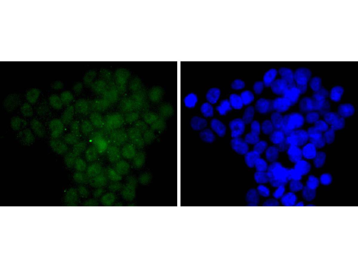 ICC staining of CDC5L in 293T cells (green). Formalin fixed cells were permeabilized with 0.1% Triton X-100 in TBS for 10 minutes at room temperature and blocked with 1% Blocker BSA for 15 minutes at room temperature. Cells were probed with the primary antibody (ET1701-75, 1/50) for 1 hour at room temperature, washed with PBS. Alexa Fluor®488 Goat anti-Rabbit IgG was used as the secondary antibody at 1/1,000 dilution. The nuclear counter stain is DAPI (blue).