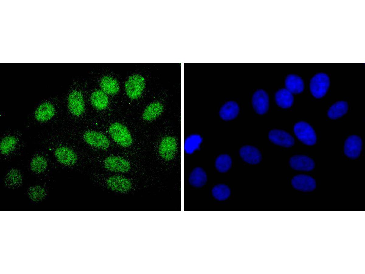 ICC staining of CDC5L in HepG2 cells (green). Formalin fixed cells were permeabilized with 0.1% Triton X-100 in TBS for 10 minutes at room temperature and blocked with 1% Blocker BSA for 15 minutes at room temperature. Cells were probed with the primary antibody (ET1701-75, 1/50) for 1 hour at room temperature, washed with PBS. Alexa Fluor®488 Goat anti-Rabbit IgG was used as the secondary antibody at 1/1,000 dilution. The nuclear counter stain is DAPI (blue).