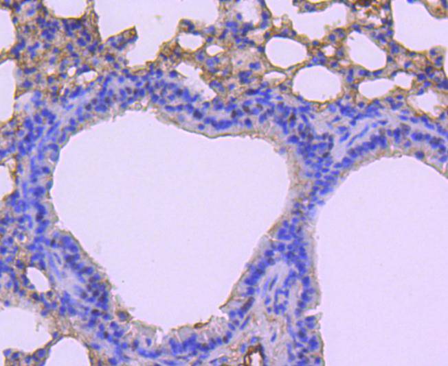 Immunohistochemical analysis of paraffin-embedded mouse lung tissue using anti-CDC5L antibody. The section was pre-treated using heat mediated antigen retrieval with Tris-EDTA buffer (pH 8.0-8.4) for 20 minutes.The tissues were blocked in 5% BSA for 30 minutes at room temperature, washed with ddH2O and PBS, and then probed with the primary antibody (ET1701-75, 1/50) for 30 minutes at room temperature. The detection was performed using an HRP conjugated compact polymer system. DAB was used as the chromogen. Tissues were counterstained with hematoxylin and mounted with DPX.