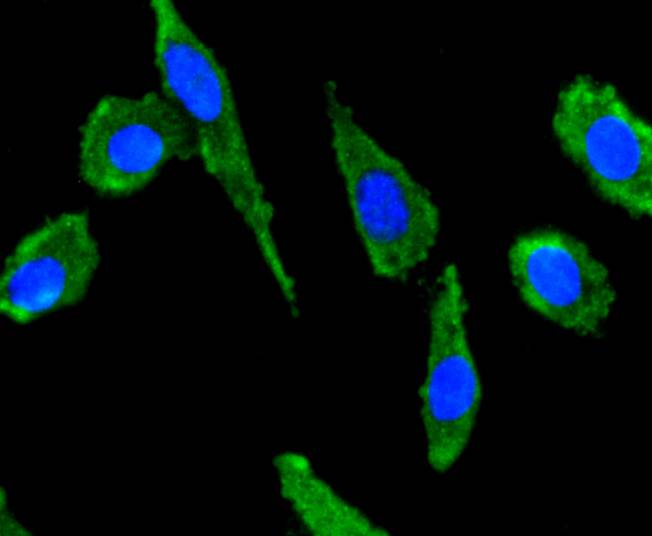 ICC staining of SDF1 in SH-SY5Y cells (green). Formalin fixed cells were permeabilized with 0.1% Triton X-100 in TBS for 10 minutes at room temperature and blocked with 1% Blocker BSA for 15 minutes at room temperature. Cells were probed with the primary antibody (ET1701-77, 1/50) for 1 hour at room temperature, washed with PBS. Alexa Fluor®488 Goat anti-Rabbit IgG was used as the secondary antibody at 1/1,000 dilution. The nuclear counter stain is DAPI (blue).