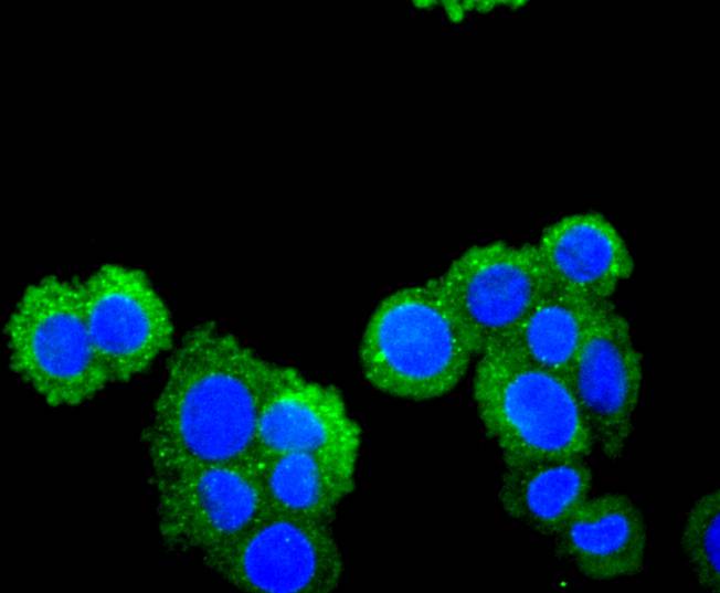 ICC staining of SDF1 in SW480 cells (green). Formalin fixed cells were permeabilized with 0.1% Triton X-100 in TBS for 10 minutes at room temperature and blocked with 1% Blocker BSA for 15 minutes at room temperature. Cells were probed with the primary antibody (ET1701-77, 1/50) for 1 hour at room temperature, washed with PBS. Alexa Fluor®488 Goat anti-Rabbit IgG was used as the secondary antibody at 1/1,000 dilution. The nuclear counter stain is DAPI (blue).