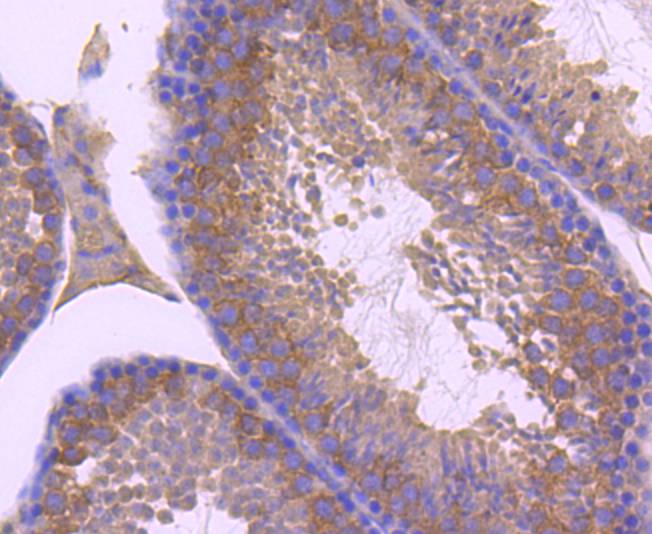 Immunohistochemical analysis of paraffin-embedded mouse testis tissue using anti-ZNRF2 antibody. The section was pre-treated using heat mediated antigen retrieval with Tris-EDTA buffer (pH 9.0) for 20 minutes.The tissues were blocked in 1% BSA for 30 minutes at room temperature, washed with ddH2O and PBS, and then probed with the primary antibody (ET1701-78, 1/50) for 30 minutes at room temperature. The detection was performed using an HRP conjugated compact polymer system. DAB was used as the chromogen. Tissues were counterstained with hematoxylin and mounted with DPX.