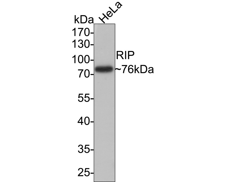 Western blot analysis of RIP on Hela cell lysates. Proteins were transferred to a PVDF membrane and blocked with 5% BSA in PBS for 1 hour at room temperature. The primary antibody (ET1701-79, 1/1,000) was used in 5% BSA at room temperature for 2 hours. Goat Anti-Rabbit IgG - HRP Secondary Antibody (HA1001) at 1:200,000 dilution was used for 1 hour at room temperature.<br />
<br />
Predicted band size: 76 kDa<br />
Observed band size: 76 kDa