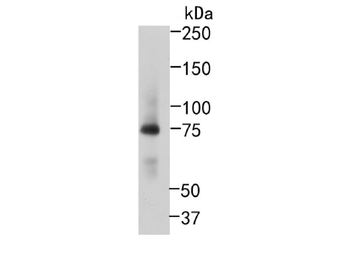 Western blot analysis of RIP on Raji cell lysates. Proteins were transferred to a PVDF membrane and blocked with 5% BSA in PBS for 1 hour at room temperature. The primary antibody (ET1701-79, 1/500) was used in 5% BSA at room temperature for 2 hours. Goat Anti-Rabbit IgG - HRP Secondary Antibody (HA1001) at 1:200,000 dilution was used for 1 hour at room temperature.<br />
<br />
Predicted band size: 76 kDa<br />
Observed band size: 76 kDa