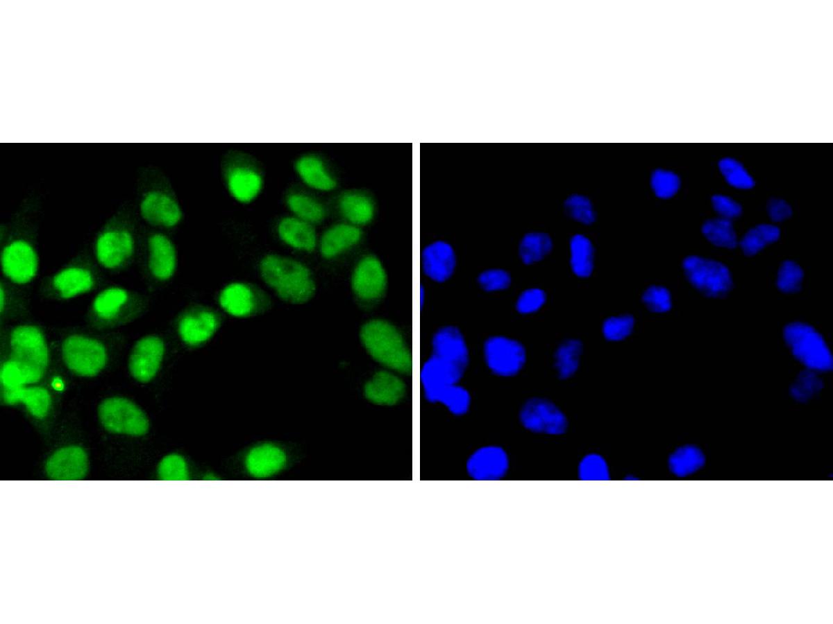 ICC staining of SUMO4 in 293 cells (green). Formalin fixed cells were permeabilized with 0.1% Triton X-100 in TBS for 10 minutes at room temperature and blocked with 10% negative goat serum for 15 minutes at room temperature. Cells were probed with the primary antibody (ET1701-8, 1/50) for 1 hour at room temperature, washed with PBS. Alexa Fluor®488 conjugate-Goat anti-Rabbit IgG was used as the secondary antibody at 1/1,000 dilution. The nuclear counter stain is DAPI (blue).