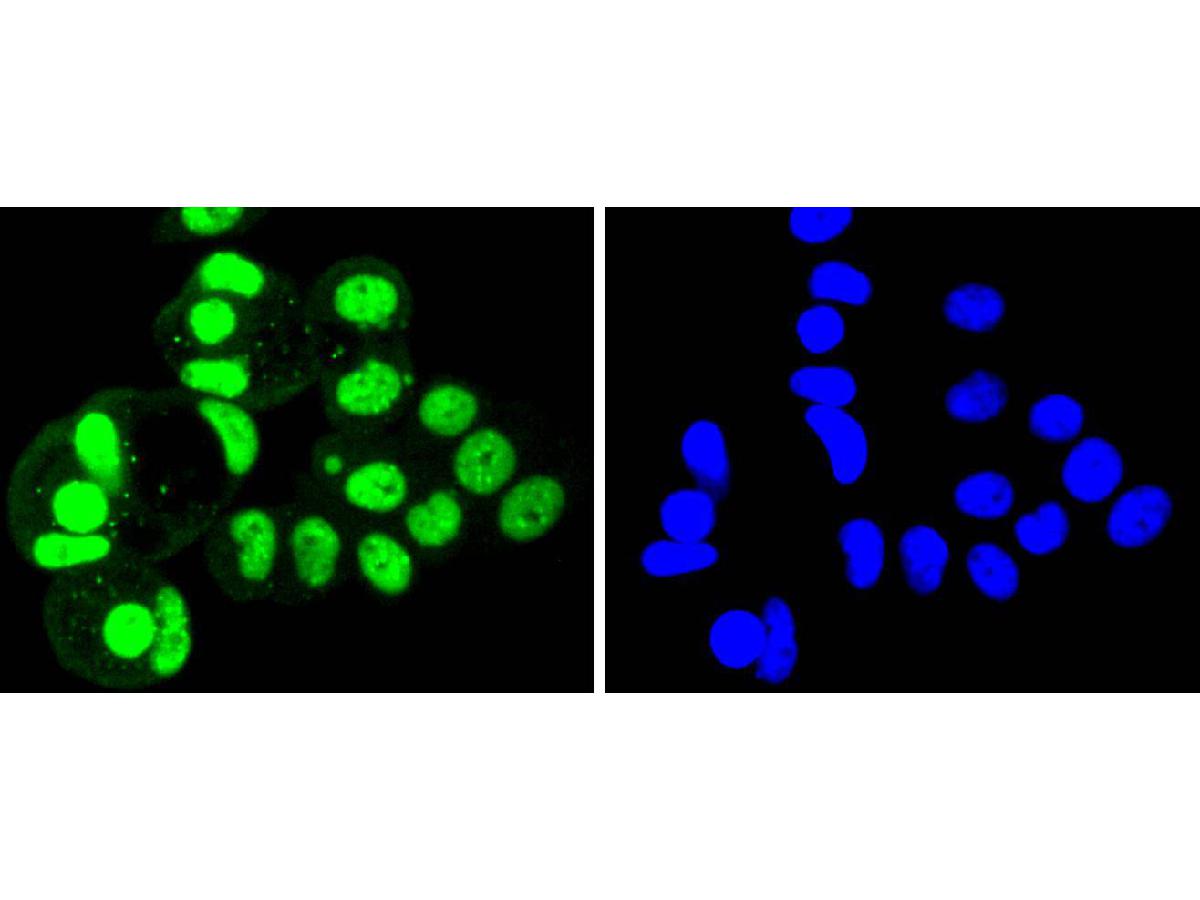 ICC staining of SUMO4 in MCF-7 cells (green). Formalin fixed cells were permeabilized with 0.1% Triton X-100 in TBS for 10 minutes at room temperature and blocked with 10% negative goat serum for 15 minutes at room temperature. Cells were probed with the primary antibody (ET1701-8, 1/50) for 1 hour at room temperature, washed with PBS. Alexa Fluor®488 conjugate-Goat anti-Rabbit IgG was used as the secondary antibody at 1/1,000 dilution. The nuclear counter stain is DAPI (blue).