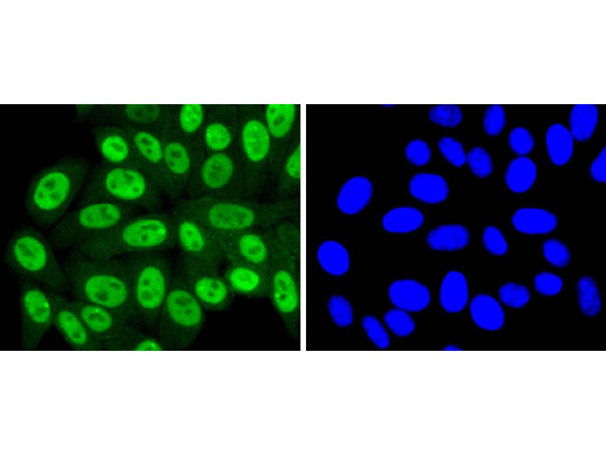 ICC staining of SUMO4 in HepG2 cells (green). Formalin fixed cells were permeabilized with 0.1% Triton X-100 in TBS for 10 minutes at room temperature and blocked with 10% negative goat serum for 15 minutes at room temperature. Cells were probed with the primary antibody (ET1701-8, 1/50) for 1 hour at room temperature, washed with PBS. Alexa Fluor®488 conjugate-Goat anti-Rabbit IgG was used as the secondary antibody at 1/1,000 dilution. The nuclear counter stain is DAPI (blue).
