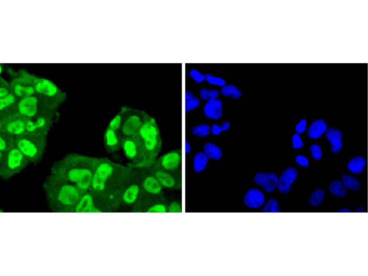 ICC staining of SUMO4 in RH-35 cells (green). Formalin fixed cells were permeabilized with 0.1% Triton X-100 in TBS for 10 minutes at room temperature and blocked with 10% negative goat serum for 15 minutes at room temperature. Cells were probed with the primary antibody (ET1701-8, 1/50) for 1 hour at room temperature, washed with PBS. Alexa Fluor®488 conjugate-Goat anti-Rabbit IgG was used as the secondary antibody at 1/1,000 dilution. The nuclear counter stain is DAPI (blue).