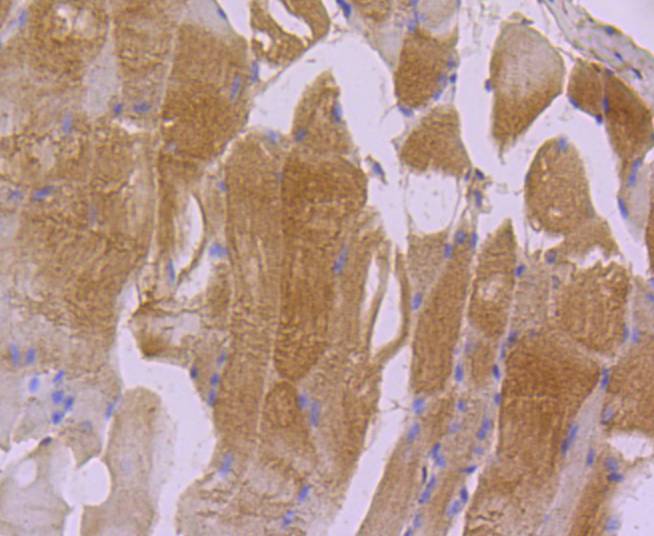 Immunohistochemical analysis of paraffin-embedded mouse cardiac muscle tissue using anti-Actin antibody. The section was pre-treated using heat mediated antigen retrieval with Tris-EDTA buffer (pH 8.0-8.4) for 20 minutes.The tissues were blocked in 5% BSA for 30 minutes at room temperature, washed with ddH2O and PBS, and then probed with the primary antibody (ET1701-80, 1/50) for 30 minutes at room temperature. The detection was performed using an HRP conjugated compact polymer system. DAB was used as the chromogen. Tissues were counterstained with hematoxylin and mounted with DPX.