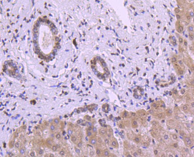 Immunohistochemical analysis of paraffin-embedded human liver tissue using anti-Histone H3 antibody. The section was pre-treated using heat mediated antigen retrieval with Tris-EDTA buffer (pH 8.0-8.4) for 20 minutes.The tissues were blocked in 5% BSA for 30 minutes at room temperature, washed with ddH2O and PBS, and then probed with the primary antibody (ET1701-81, 1/50) for 30 minutes at room temperature. The detection was performed using an HRP conjugated compact polymer system. DAB was used as the chromogen. Tissues were counterstained with hematoxylin and mounted with DPX.