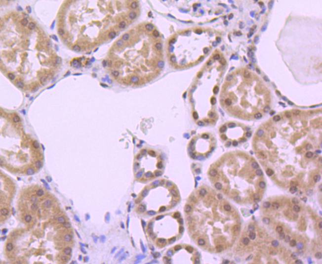 Immunohistochemical analysis of paraffin-embedded human kidney  tissue using anti-Histone H3 antibody. The section was pre-treated using heat mediated antigen retrieval with Tris-EDTA buffer (pH 8.0-8.4) for 20 minutes.The tissues were blocked in 5% BSA for 30 minutes at room temperature, washed with ddH2O and PBS, and then probed with the primary antibody (ET1701-81, 1/50) for 30 minutes at room temperature. The detection was performed using an HRP conjugated compact polymer system. DAB was used as the chromogen. Tissues were counterstained with hematoxylin and mounted with DPX.