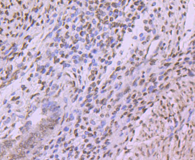 Immunohistochemical analysis of paraffin-embedded human uterus tissue using anti-Histone H3 antibody. The section was pre-treated using heat mediated antigen retrieval with Tris-EDTA buffer (pH 8.0-8.4) for 20 minutes.The tissues were blocked in 5% BSA for 30 minutes at room temperature, washed with ddH2O and PBS, and then probed with the primary antibody (ET1701-81, 1/50) for 30 minutes at room temperature. The detection was performed using an HRP conjugated compact polymer system. DAB was used as the chromogen. Tissues were counterstained with hematoxylin and mounted with DPX.
