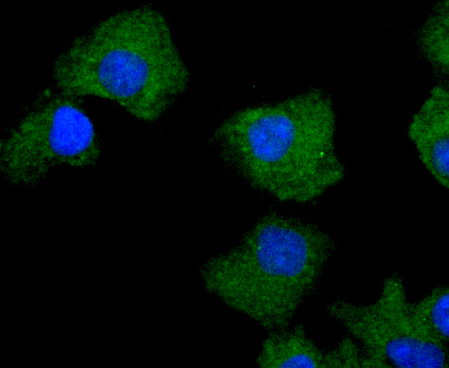 ICC staining of PKC delta in A549 cells (green). Formalin fixed cells were permeabilized with 0.1% Triton X-100 in TBS for 10 minutes at room temperature and blocked with 1% Blocker BSA for 15 minutes at room temperature. Cells were probed with the primary antibody (ET1701-85, 1/50) for 1 hour at room temperature, washed with PBS. Alexa Fluor®488 Goat anti-Rabbit IgG was used as the secondary antibody at 1/1,000 dilution. The nuclear counter stain is DAPI (blue).