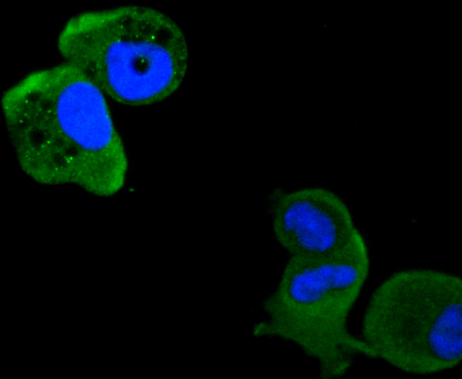 ICC staining of PKC delta in MCF-7 cells (green). Formalin fixed cells were permeabilized with 0.1% Triton X-100 in TBS for 10 minutes at room temperature and blocked with 1% Blocker BSA for 15 minutes at room temperature. Cells were probed with the primary antibody (ET1701-85, 1/50) for 1 hour at room temperature, washed with PBS. Alexa Fluor®488 Goat anti-Rabbit IgG was used as the secondary antibody at 1/1,000 dilution. The nuclear counter stain is DAPI (blue).