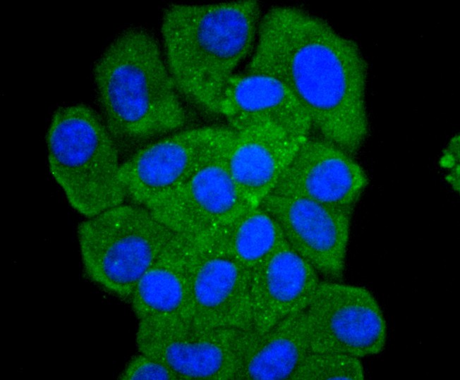 ICC staining of PKC delta in HepG2 cells (green). Formalin fixed cells were permeabilized with 0.1% Triton X-100 in TBS for 10 minutes at room temperature and blocked with 1% Blocker BSA for 15 minutes at room temperature. Cells were probed with the primary antibody (ET1701-85, 1/50) for 1 hour at room temperature, washed with PBS. Alexa Fluor®488 Goat anti-Rabbit IgG was used as the secondary antibody at 1/1,000 dilution. The nuclear counter stain is DAPI (blue).