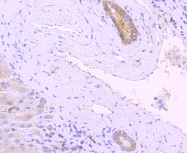 Immunohistochemical analysis of paraffin-embedded human liver tissue using anti-PKC delta antibody. The section was pre-treated using heat mediated antigen retrieval with Tris-EDTA buffer (pH 8.0-8.4) for 20 minutes.The tissues were blocked in 5% BSA for 30 minutes at room temperature, washed with ddH2O and PBS, and then probed with the primary antibody (ET1701-85, 1/50) for 30 minutes at room temperature. The detection was performed using an HRP conjugated compact polymer system. DAB was used as the chromogen. Tissues were counterstained with hematoxylin and mounted with DPX.