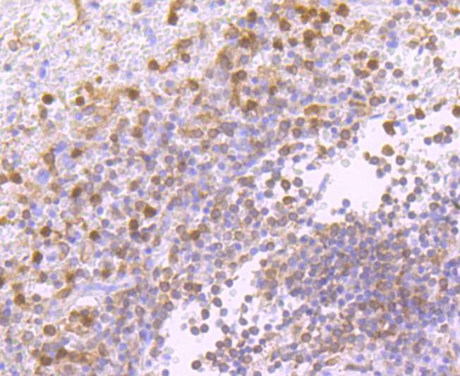 Immunohistochemical analysis of paraffin-embedded human spleen tissue using anti-PKC delta antibody. The section was pre-treated using heat mediated antigen retrieval with Tris-EDTA buffer (pH 8.0-8.4) for 20 minutes.The tissues were blocked in 5% BSA for 30 minutes at room temperature, washed with ddH2O and PBS, and then probed with the primary antibody (ET1701-85, 1/50) for 30 minutes at room temperature. The detection was performed using an HRP conjugated compact polymer system. DAB was used as the chromogen. Tissues were counterstained with hematoxylin and mounted with DPX.