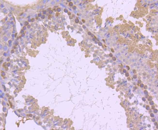 Immunohistochemical analysis of paraffin-embedded mouse testis tissue using anti-PKC delta antibody. The section was pre-treated using heat mediated antigen retrieval with Tris-EDTA buffer (pH 8.0-8.4) for 20 minutes.The tissues were blocked in 5% BSA for 30 minutes at room temperature, washed with ddH2O and PBS, and then probed with the primary antibody (ET1701-85, 1/50) for 30 minutes at room temperature. The detection was performed using an HRP conjugated compact polymer system. DAB was used as the chromogen. Tissues were counterstained with hematoxylin and mounted with DPX.