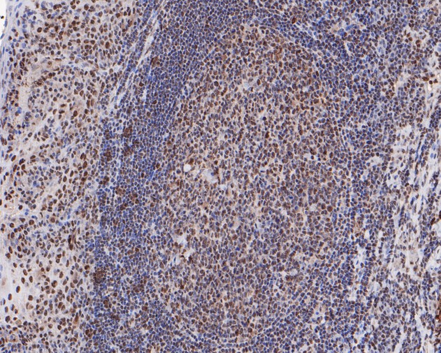 Immunohistochemical analysis of paraffin-embedded mouse brain tissue using anti-FUS/TLS antibody. The section was pre-treated using heat mediated antigen retrieval with sodium citrate buffer (pH 6.0) for 20 minutes. The tissues were blocked in 5% BSA for 30 minutes at room temperature, washed with ddH2O and PBS, and then probed with the primary antibody (ET1701-86, 1/200)  for 30 minutes at room temperature. The detection was performed using an HRP conjugated compact polymer system. DAB was used as the chromogen. Tissues were counterstained with hematoxylin and mounted with DPX.