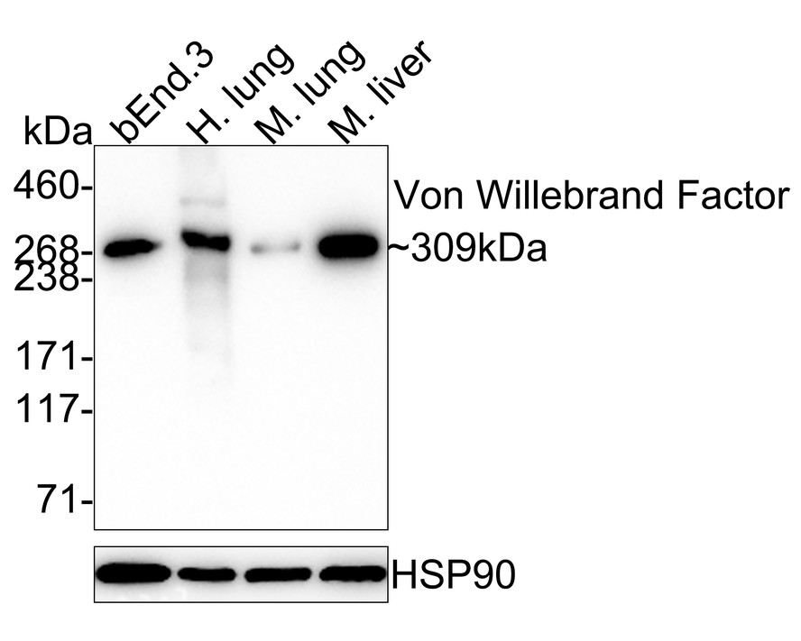 Western blot analysis of Von Willebrand Factor on human lung lysates with Rabbit anti-Von Willebrand Factor antibody (ET1701-87) at 1/1000 dilution.<br />
<br />
Lysates/proteins at 20 µg/Lane.<br />
<br />
Predicted band size: 309 kDa<br />
Observed band size: 250 kDa<br />
<br />
<br />
Proteins were transferred to a PVDF membrane and blocked with 5% NFDM/TBST for 1 hour at room temperature. The primary antibody (ET1701-87) at 1/500 dilution was used in 5% NFDM/TBST at room temperature for 2 hours. Goat Anti-Rabbit IgG - HRP Secondary Antibody (HA1001) at 1:300,000 dilution was used for 1 hour at room temperature.