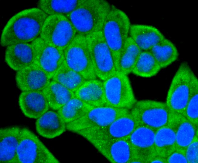 ICC staining of IGF2 in Hela cells (green). Formalin fixed cells were permeabilized with 0.1% Triton X-100 in TBS for 10 minutes at room temperature and blocked with 10% negative goat serum for 15 minutes at room temperature. Cells were probed with the primary antibody (ET1701-88, 1/50) for 1 hour at room temperature, washed with PBS. Alexa Fluor®488 conjugate-Goat anti-Rabbit IgG was used as the secondary antibody at 1/1,000 dilution. The nuclear counter stain is DAPI (blue).