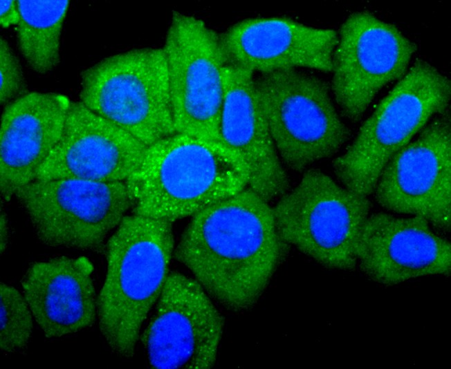 ICC staining of IGF2 in HepG2 cells (green). Formalin fixed cells were permeabilized with 0.1% Triton X-100 in TBS for 10 minutes at room temperature and blocked with 10% negative goat serum for 15 minutes at room temperature. Cells were probed with the primary antibody (ET1701-88, 1/50) for 1 hour at room temperature, washed with PBS. Alexa Fluor®488 conjugate-Goat anti-Rabbit IgG was used as the secondary antibody at 1/1,000 dilution. The nuclear counter stain is DAPI (blue).