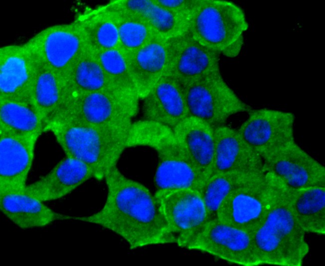 ICC staining of IGF2 in 293 cells (green). Formalin fixed cells were permeabilized with 0.1% Triton X-100 in TBS for 10 minutes at room temperature and blocked with 10% negative goat serum for 15 minutes at room temperature. Cells were probed with the primary antibody (ET1701-88, 1/50) for 1 hour at room temperature, washed with PBS. Alexa Fluor®488 conjugate-Goat anti-Rabbit IgG was used as the secondary antibody at 1/1,000 dilution. The nuclear counter stain is DAPI (blue).