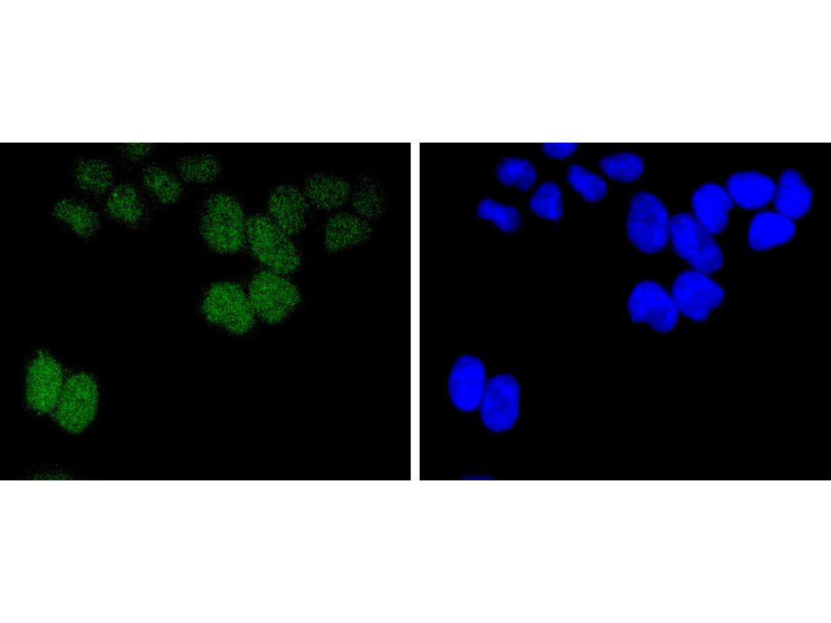 ICC staining of Bmi1 in Hela cells (green). Formalin fixed cells were permeabilized with 0.1% Triton X-100 in TBS for 10 minutes at room temperature and blocked with 1% Blocker BSA for 15 minutes at room temperature. Cells were probed with the primary antibody (ET1701-89, 1/50) for 1 hour at room temperature, washed with PBS. Alexa Fluor®488 Goat anti-Rabbit IgG was used as the secondary antibody at 1/1,000 dilution. The nuclear counter stain is DAPI (blue).